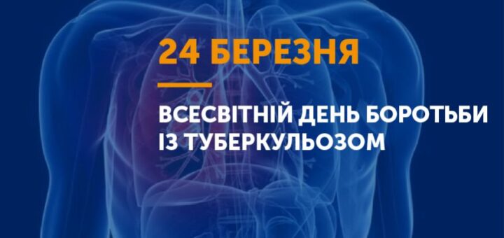 Так! Ми можемо зупинити туберкульоз!